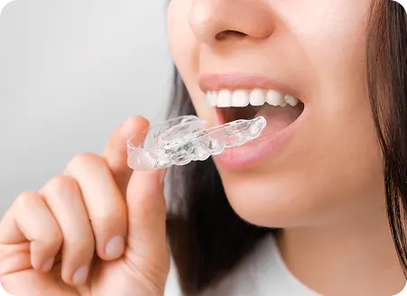 Your Local Specialist in Invisalign® & Teeth Straightening