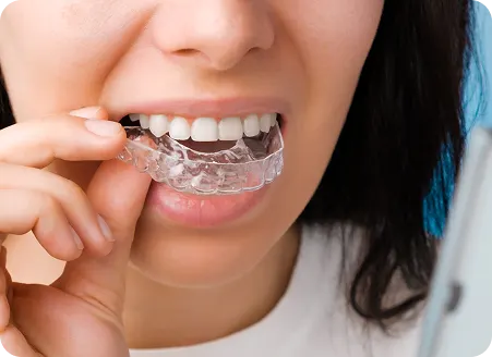 Why Choose Us for Teeth Straightening in Clifton?