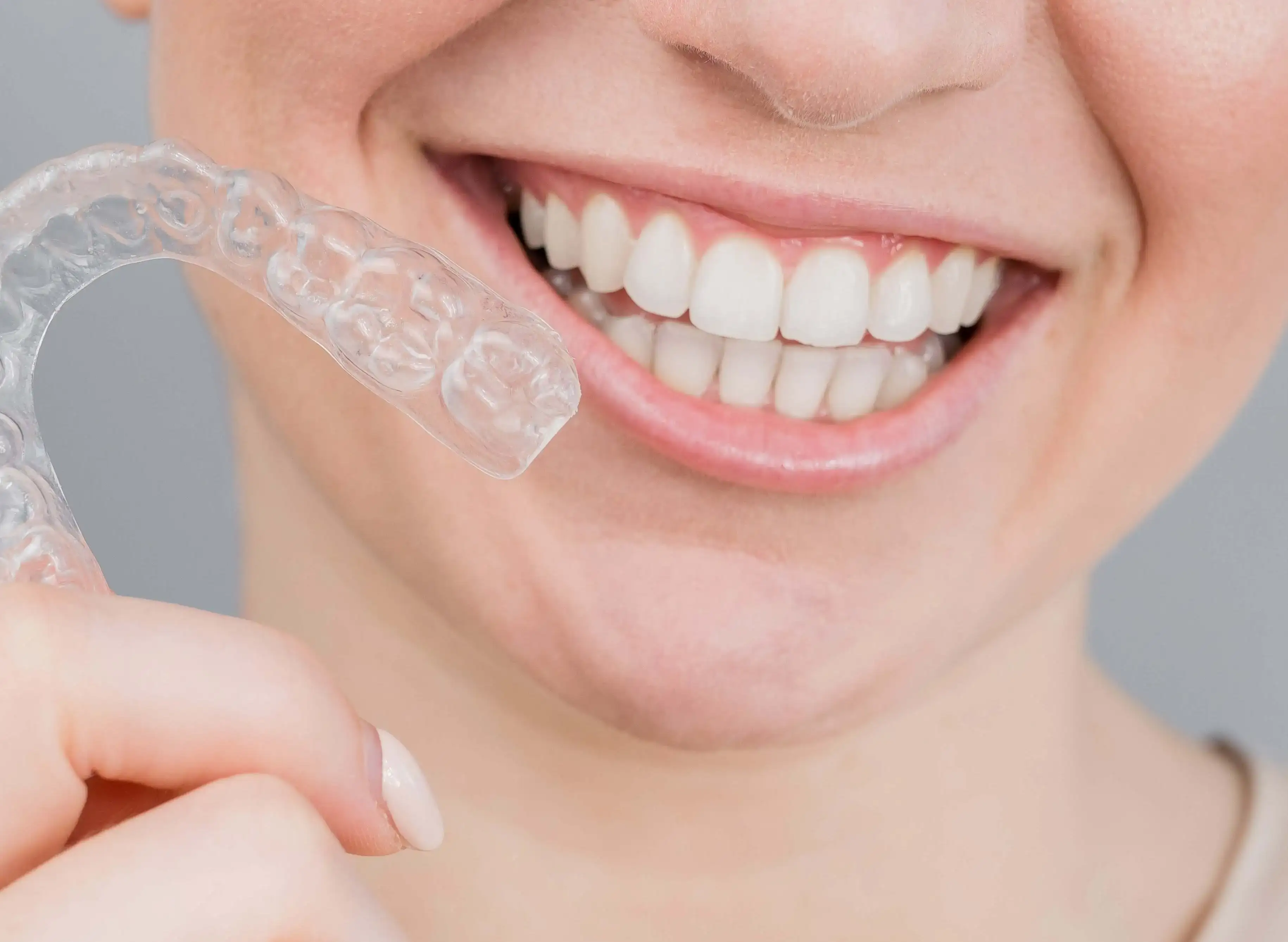 Why Choose Us for Orthodontic Treatment in Kingswood?