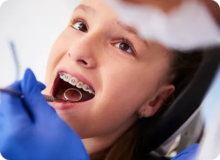 Braces for All Ages Clifton-Based Orthodontic Care