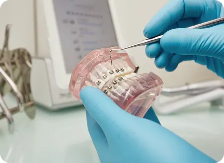 Why Patients Choose Us for Braces in Clifton